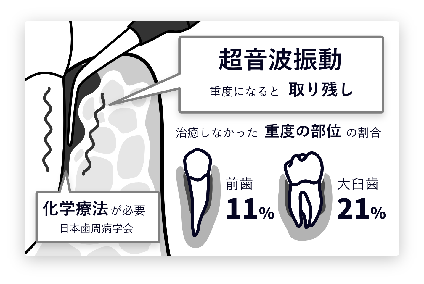 ブルーラジカル