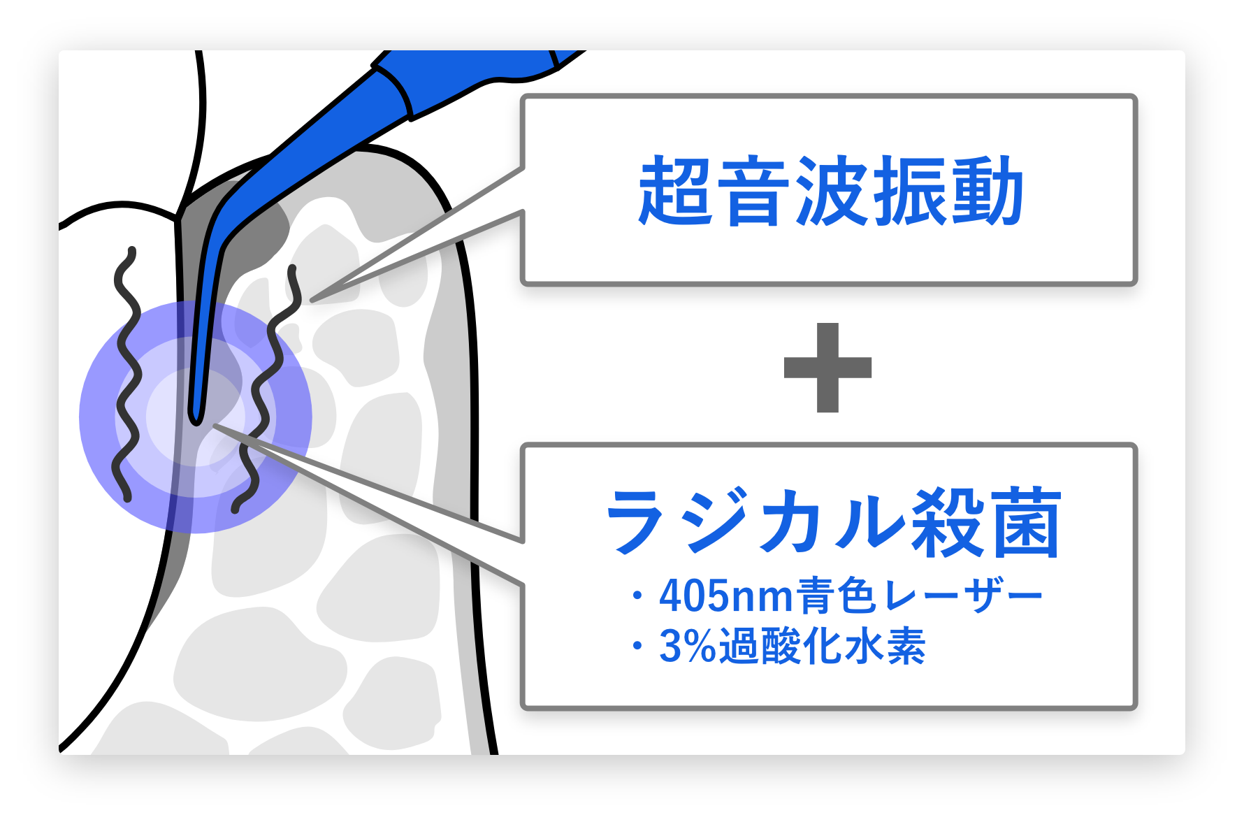 ブルーラジカル